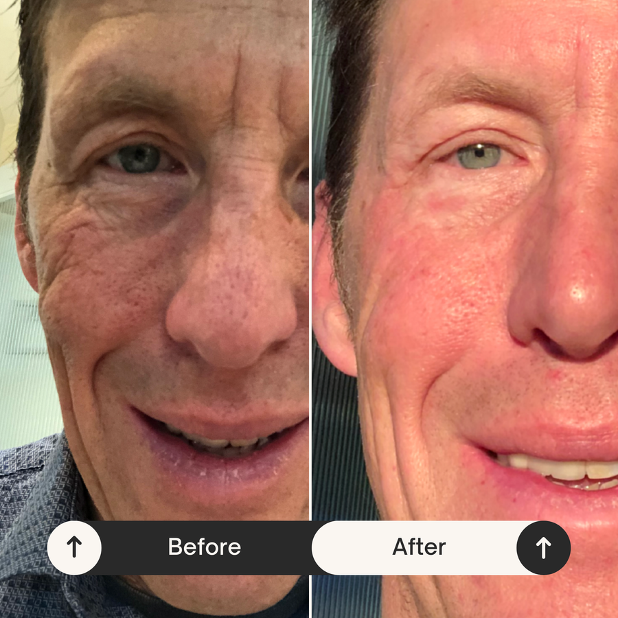 Before and after results