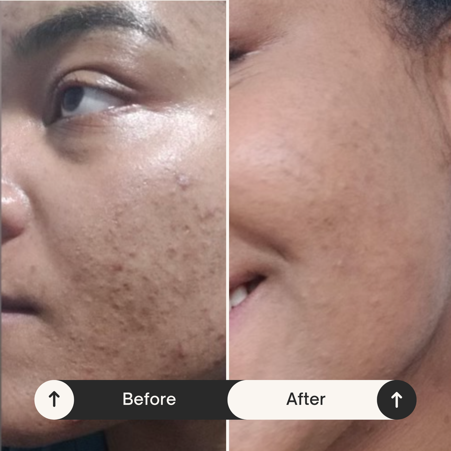 Before and after results