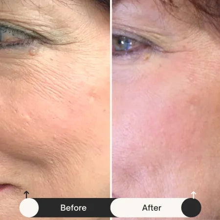 Before and after results