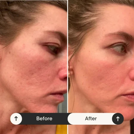 Before and after results